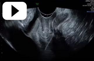 Urethra Bladder anterior and posterior vaginal walls